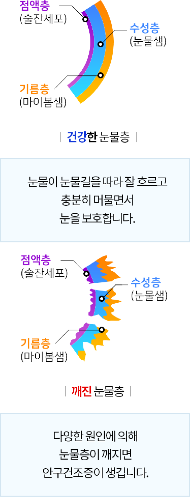 건강한 눈물층, 깨진 눈물층 그림