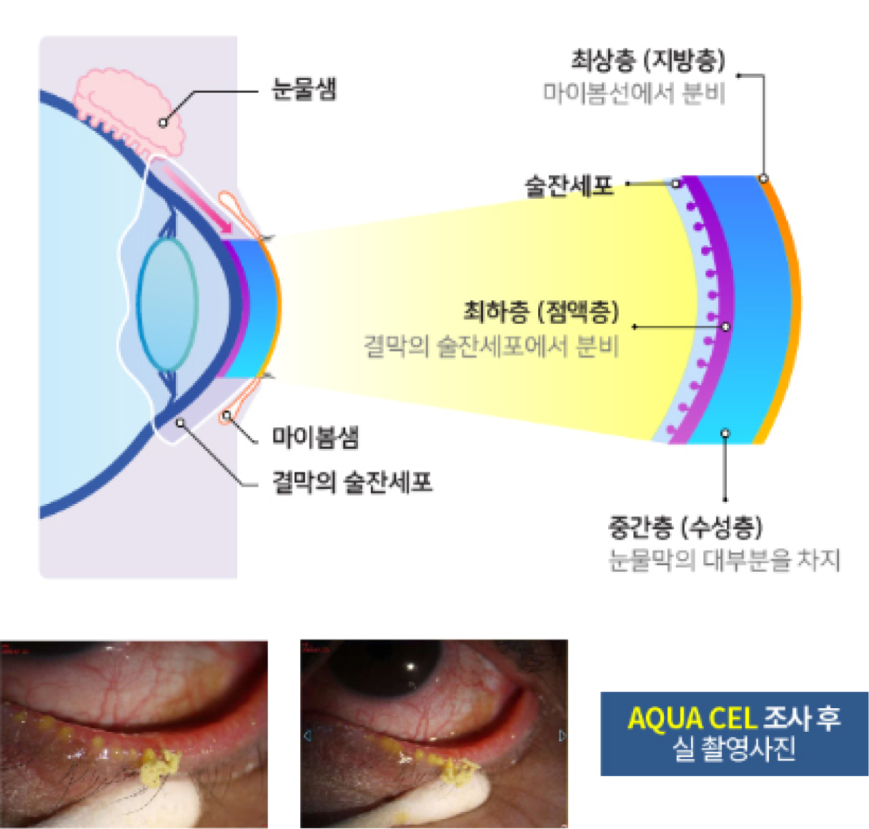 눈물샘