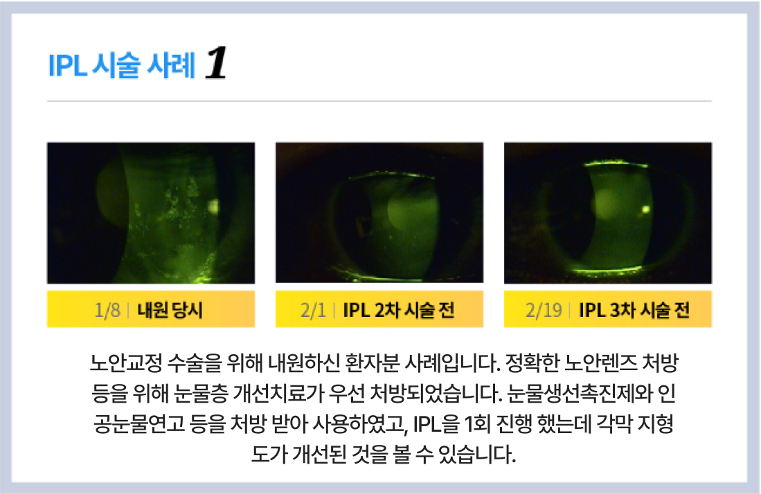 시술사례1