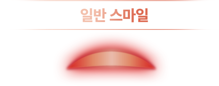 일반 스마일