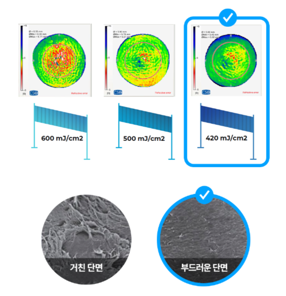 렌티큘 단면