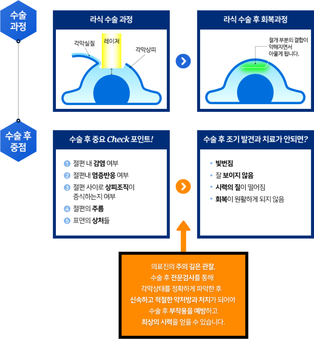 라식 수술