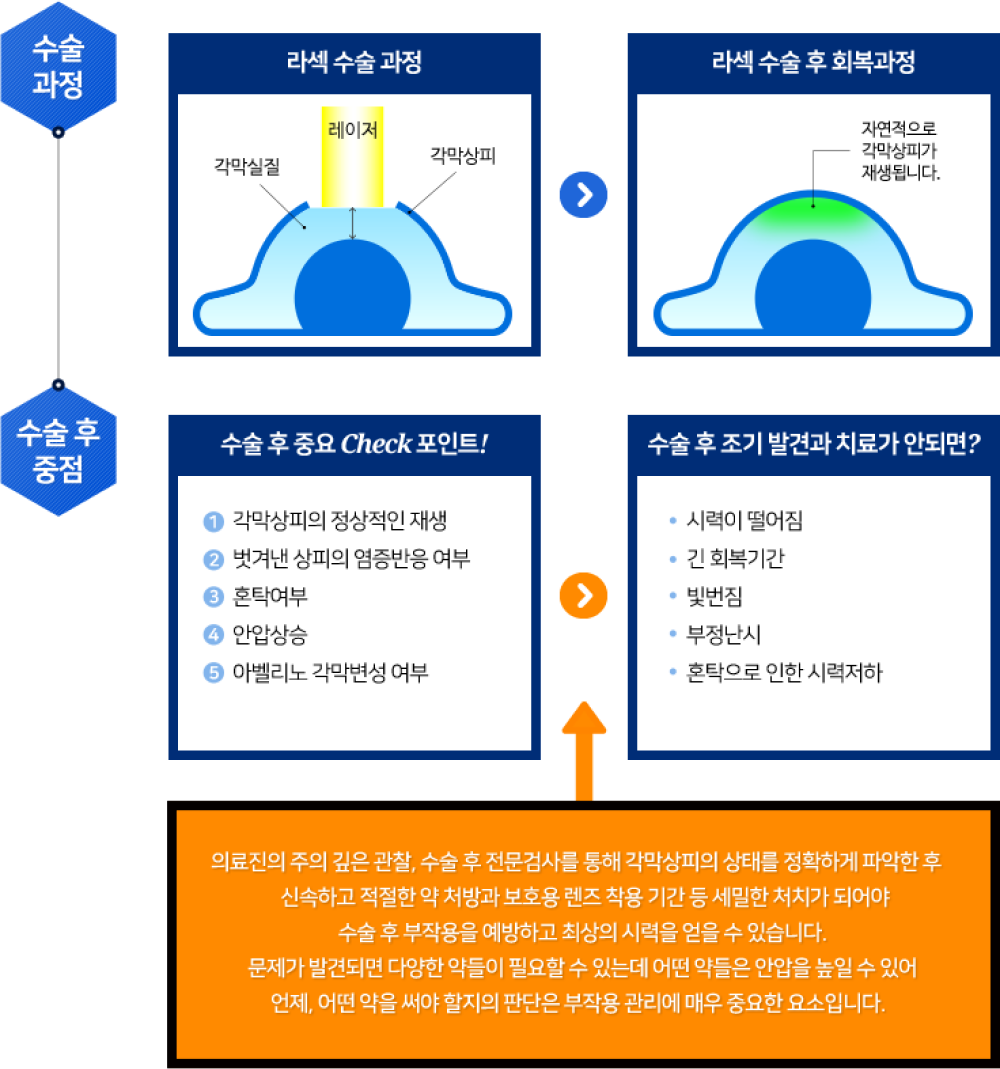 라섹 수술