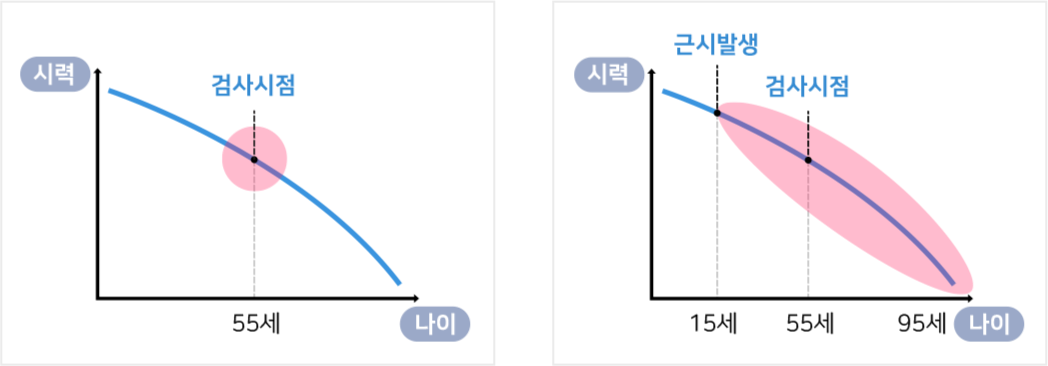 정시형노안/근시형노안/원시형노안