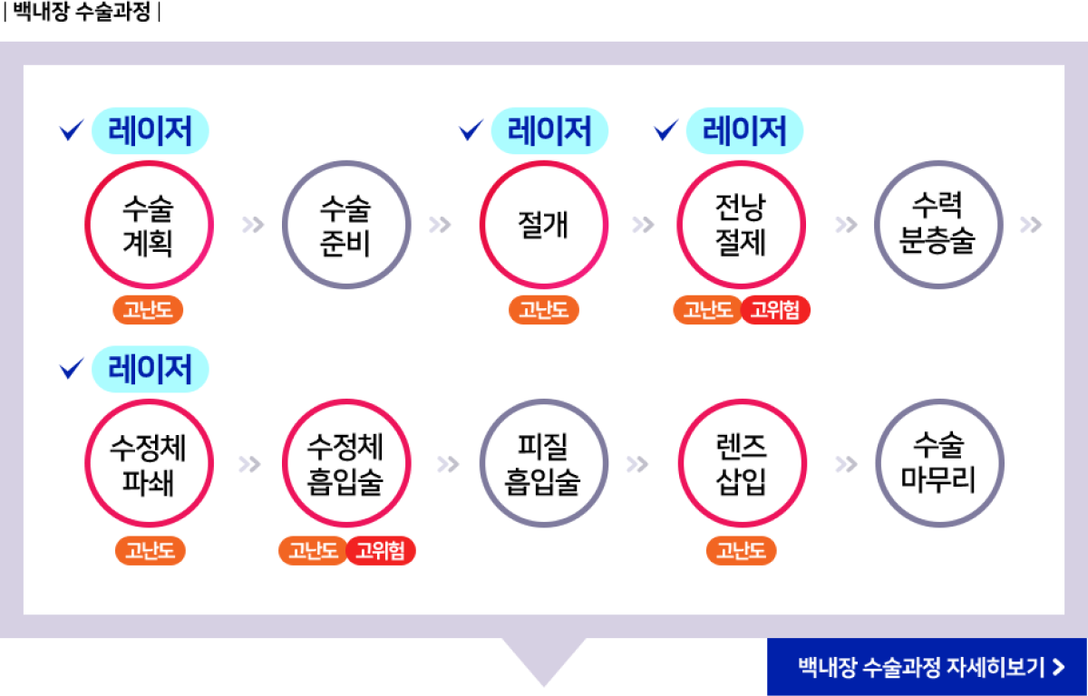 백내장 수술과정