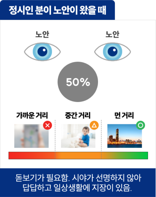 정시인 분이 노안이 왔을때 