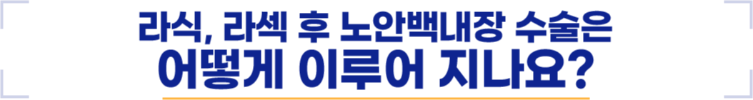 라식, 라섹 후 노안백내장 수술은 어떻게 이루어지나요?