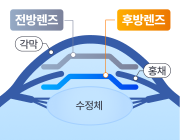 전방렌즈와 후방렌즈