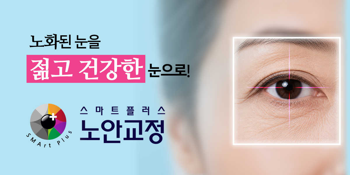 노화된 눈을 젊고 건강한 눈으로! 스마트플러스 노안교정