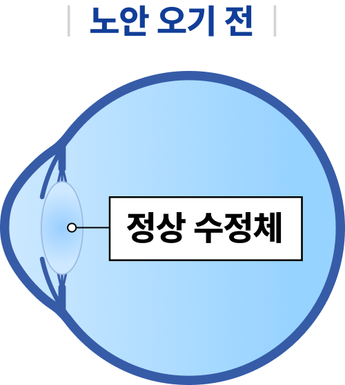 정상 수정체