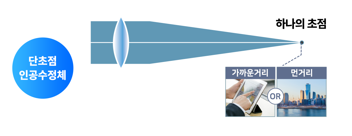 단초점 인공수정체