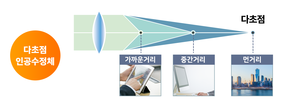 다초점 인공수정체