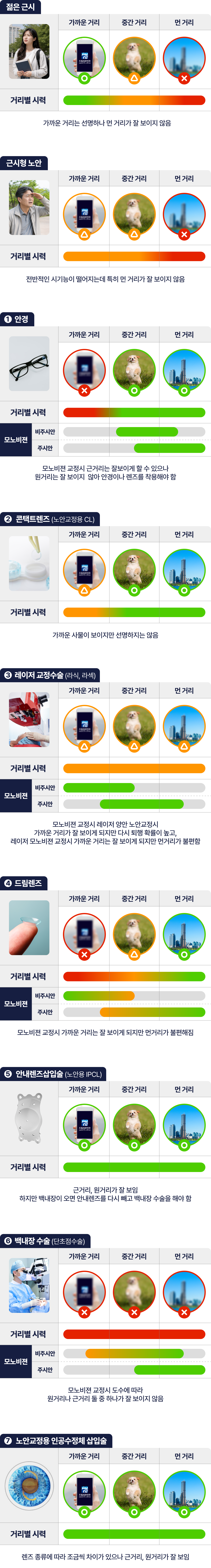근시형 노안 내용