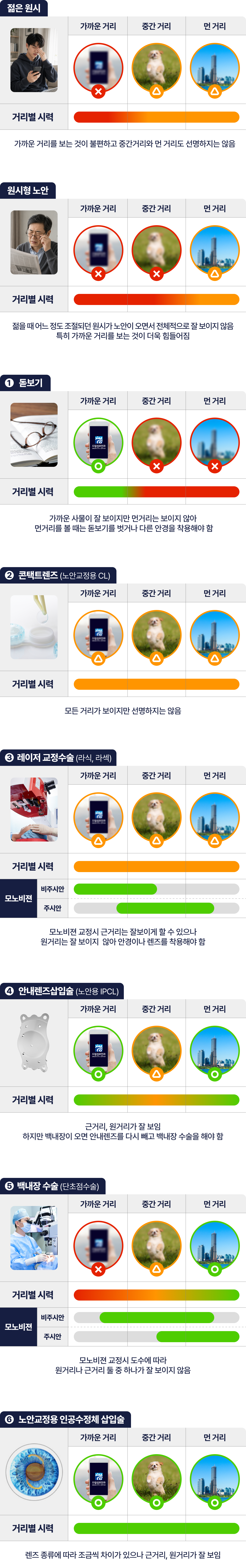 원시형 노안 내용
